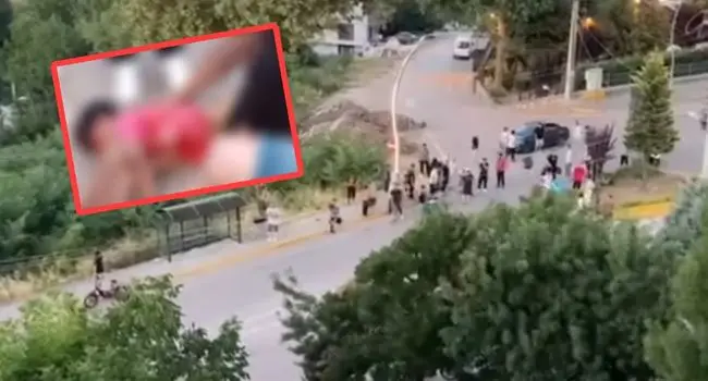 Başiskele’de mahalleliyi sokağa döken kaza! Motor çarptı, 3 yaşındaki çocuk ağır yaralı