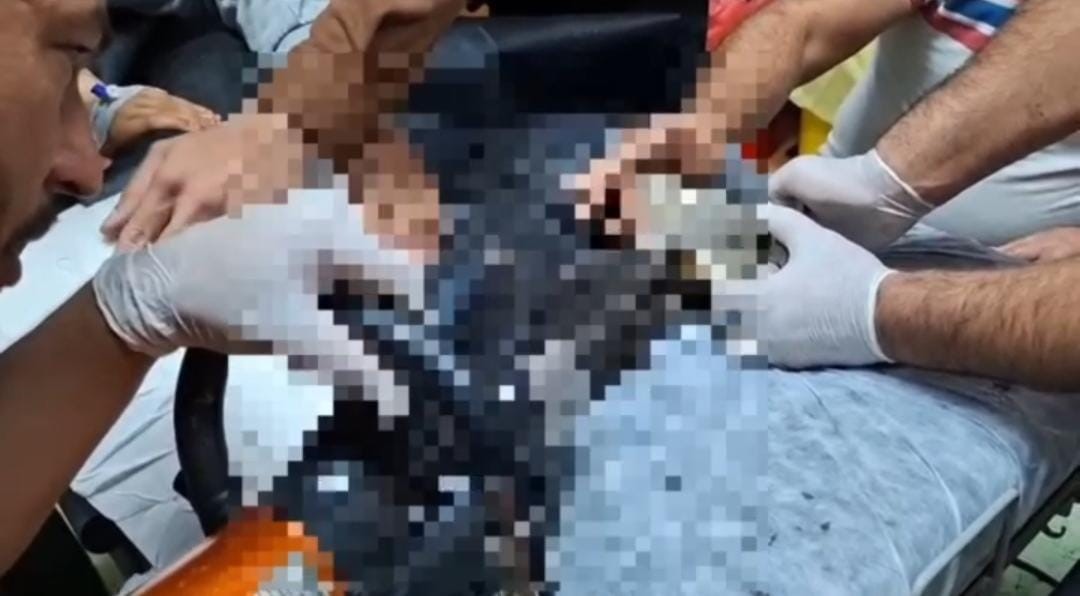 Çocuk elini kıyma makinesine kaptırdı!