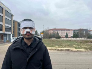 Eskişehir'de Rehber Öğretmen Sıcak Çayla Saldırdı