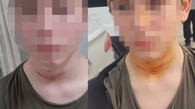 İzmit’teki okulda akran zorbalığı! Öldüresiye darp edildi