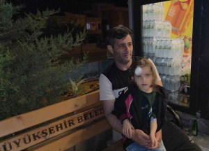 Hatay'da Yola Fırlayan Çocuğa Otomobil Çarptı