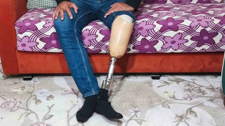Protez Bacaklı Adam Dolandırıcılık Suçlamasıyla Cezaevine Girdi