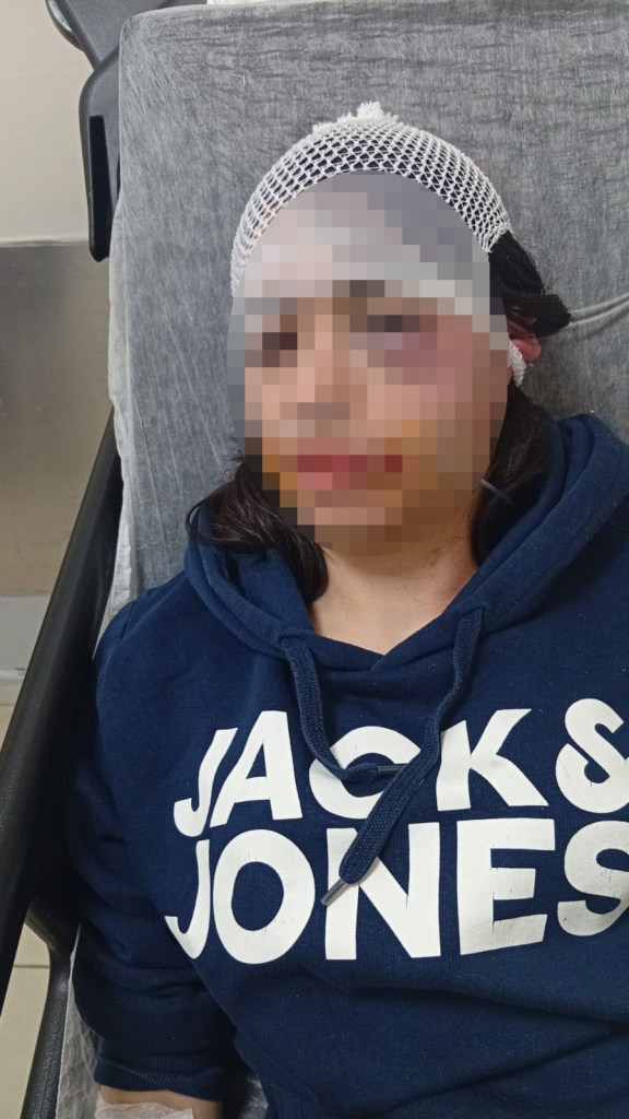 Ayrılmak isteyen genç kadına şiddet davasında yeni gelişme