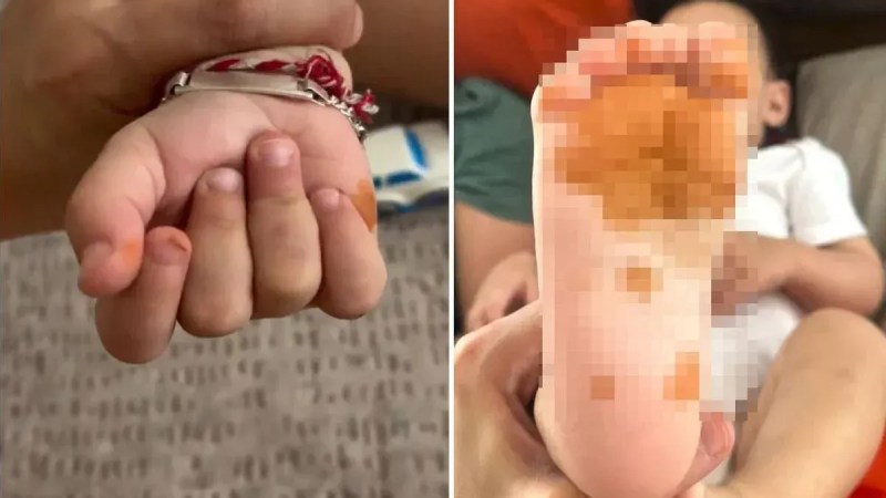 Çocuğunun elindeki renk değişimi anneyi korkuttu