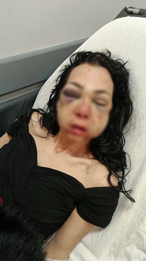 Anneye kül tablasıyla saldıran sanık tutuklandı!