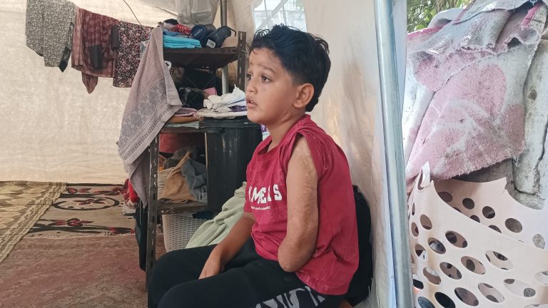 7 yaşındaki Kinan yeni protez kol bekliyor