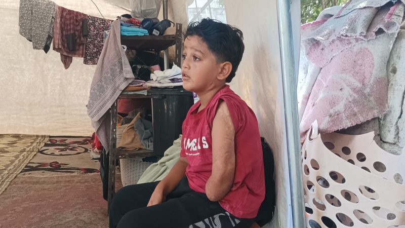 7 yaşındaki Kinan yeni protez kol bekliyor