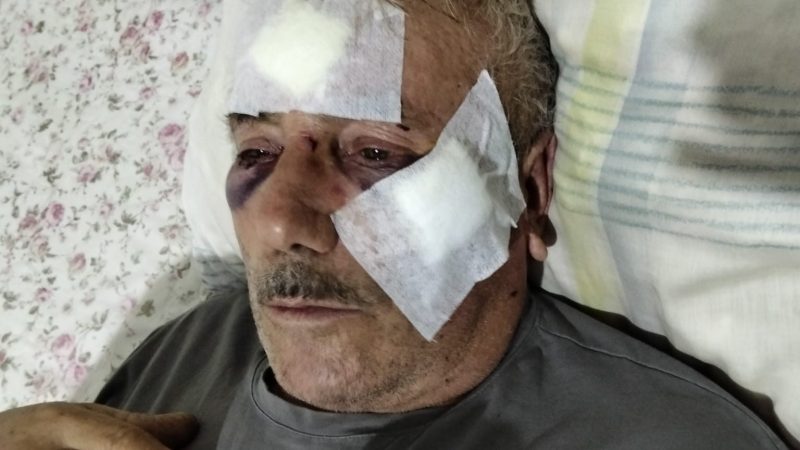 68 yaşındaki komşusunu muştayla darbetti!