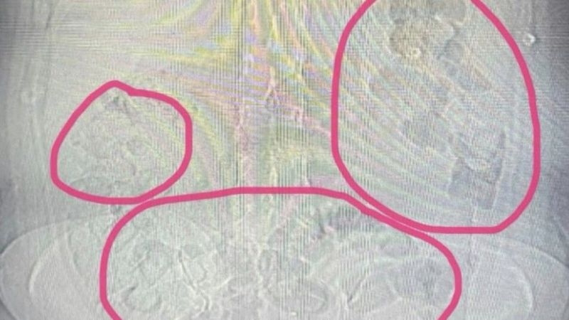 Otobüste yakalandı: Uyuşturucu midesinden çıktı!